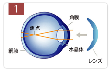 寝る前にレンズを装用